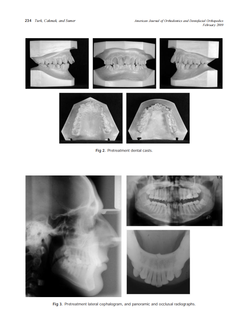 2009_135_2_232_240_Turk.pdf 第3页