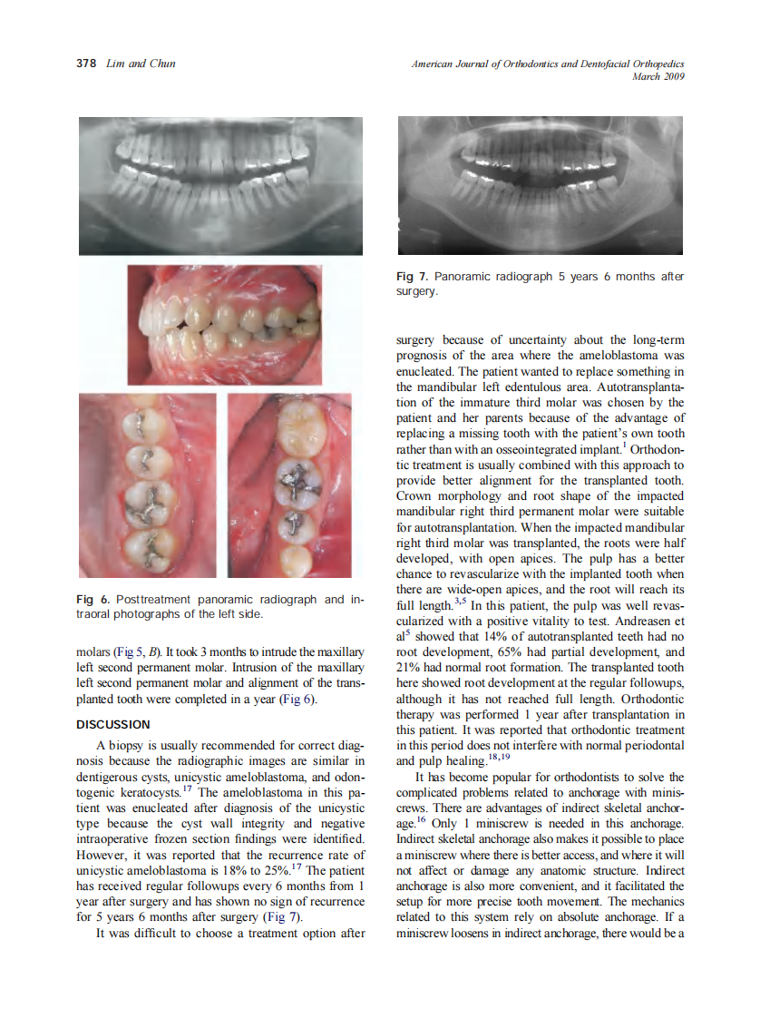 2009_135_3_375_379_Lim.pdf 第4页