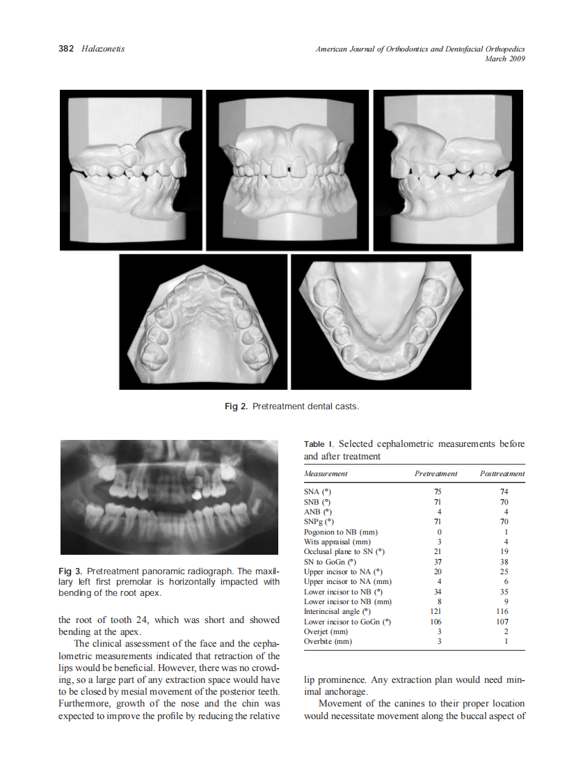2009_135_3_380_389_Halazonetis.pdf 第3页