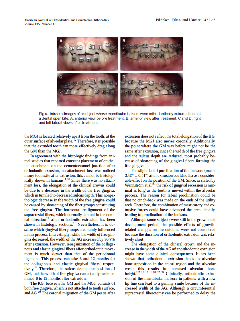 2009_135_4_432.e1_432.e6_Pikdoken.pdf 第5页