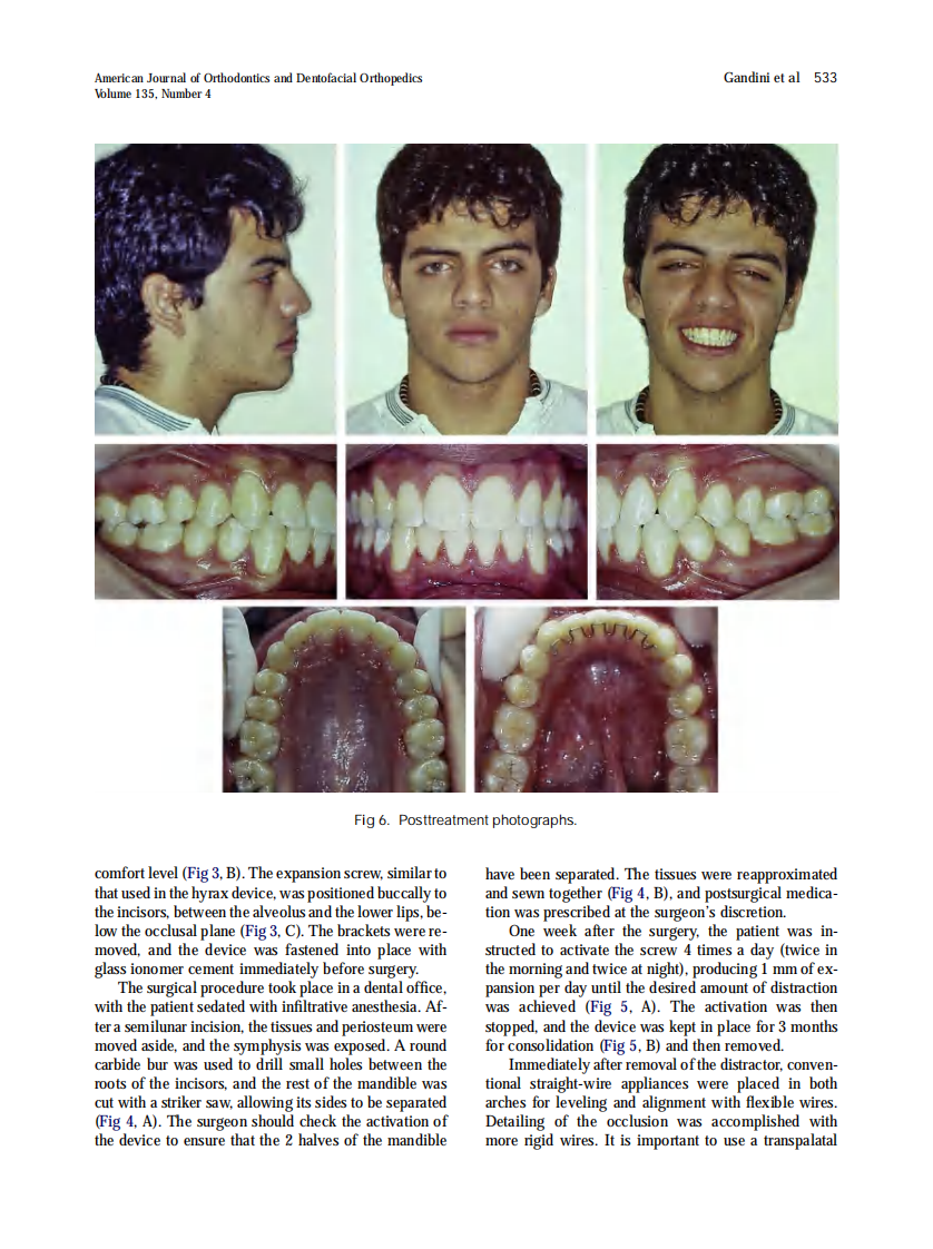 2009_135_4_530_535_Gandini-Jr.pdf 第4页