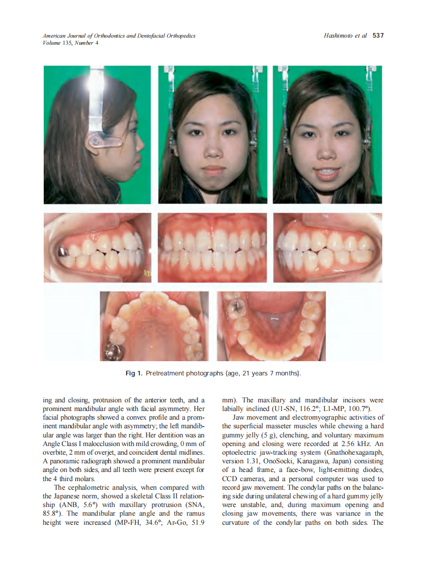 2009_135_4_536_548_Hashimoto.pdf 第2页