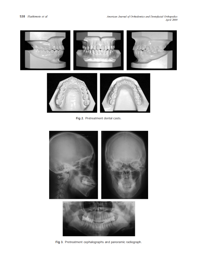 2009_135_4_536_548_Hashimoto.pdf 第3页