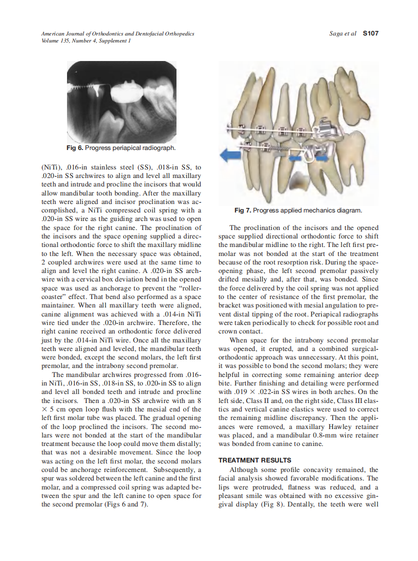 2009_135_4-Suppl-1_S103_S112_Saga.pdf 第5页
