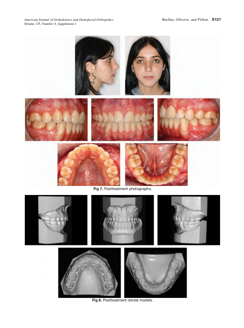 2009_135_4-Suppl-1_S133_S139_de-Oliveira-Ruellas.pdf 第5页