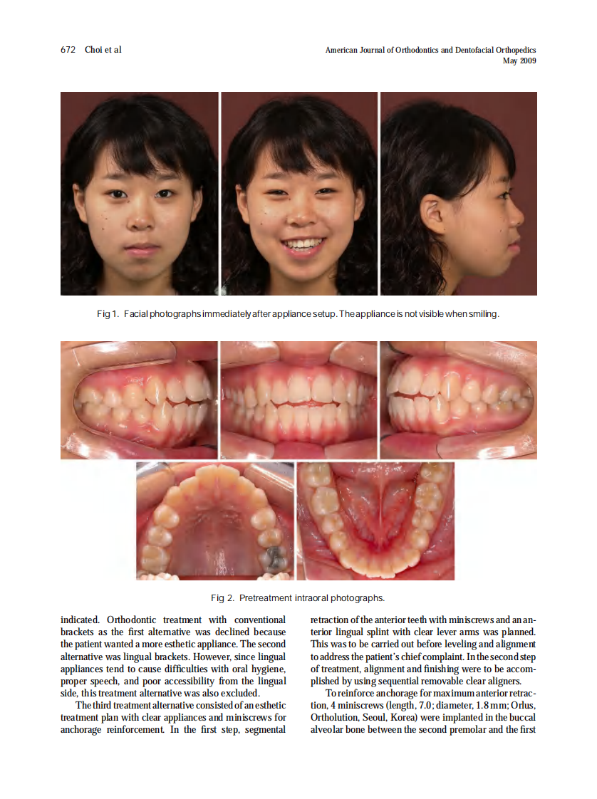 2009_135_5_671_681_Choi.pdf 第2页