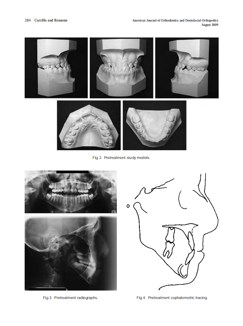 2009_136_2_282_289.pdf 第3页