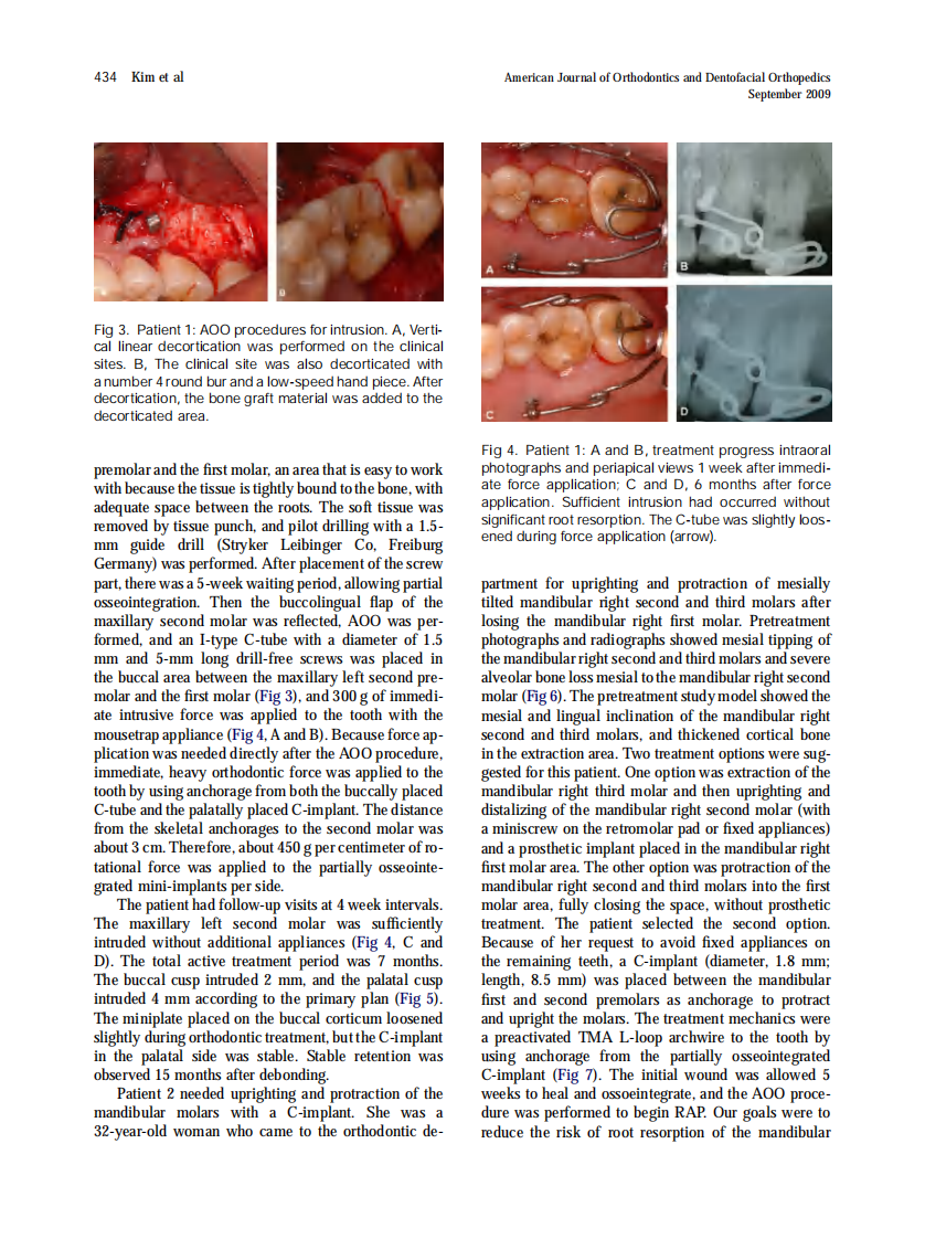 2009_136_3_431_439.pdf 第4页