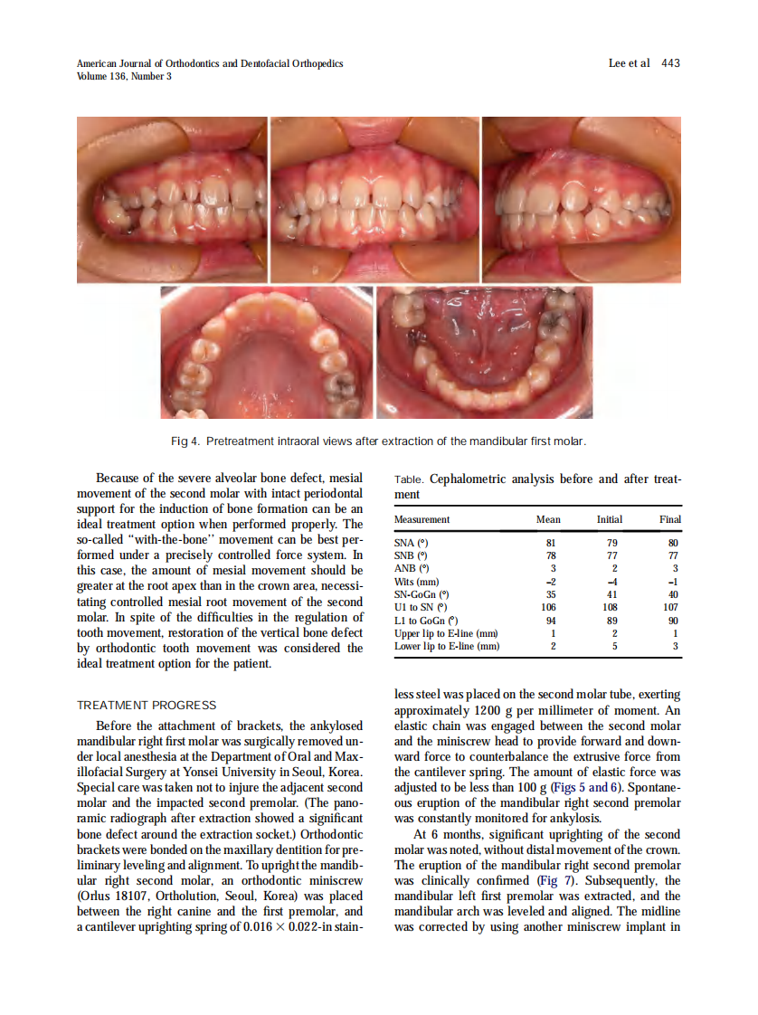 2009_136_3_440_449.pdf 第4页