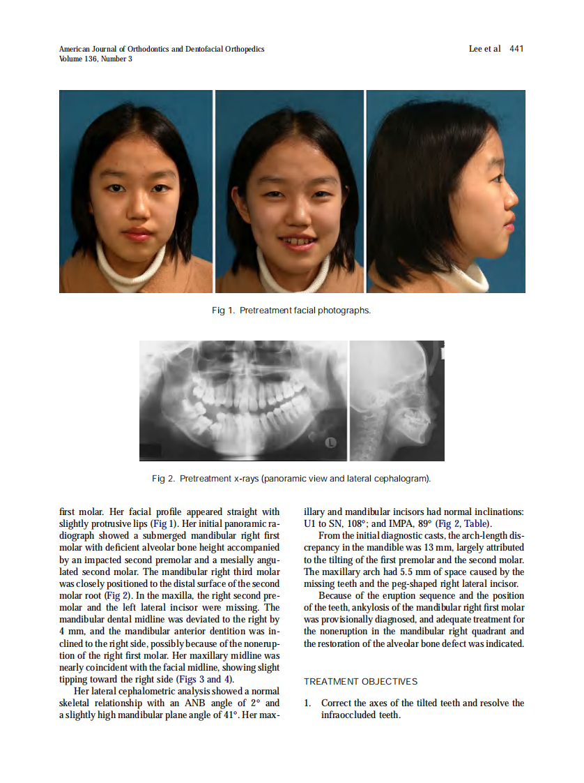 2009_136_3_440_449.pdf 第2页