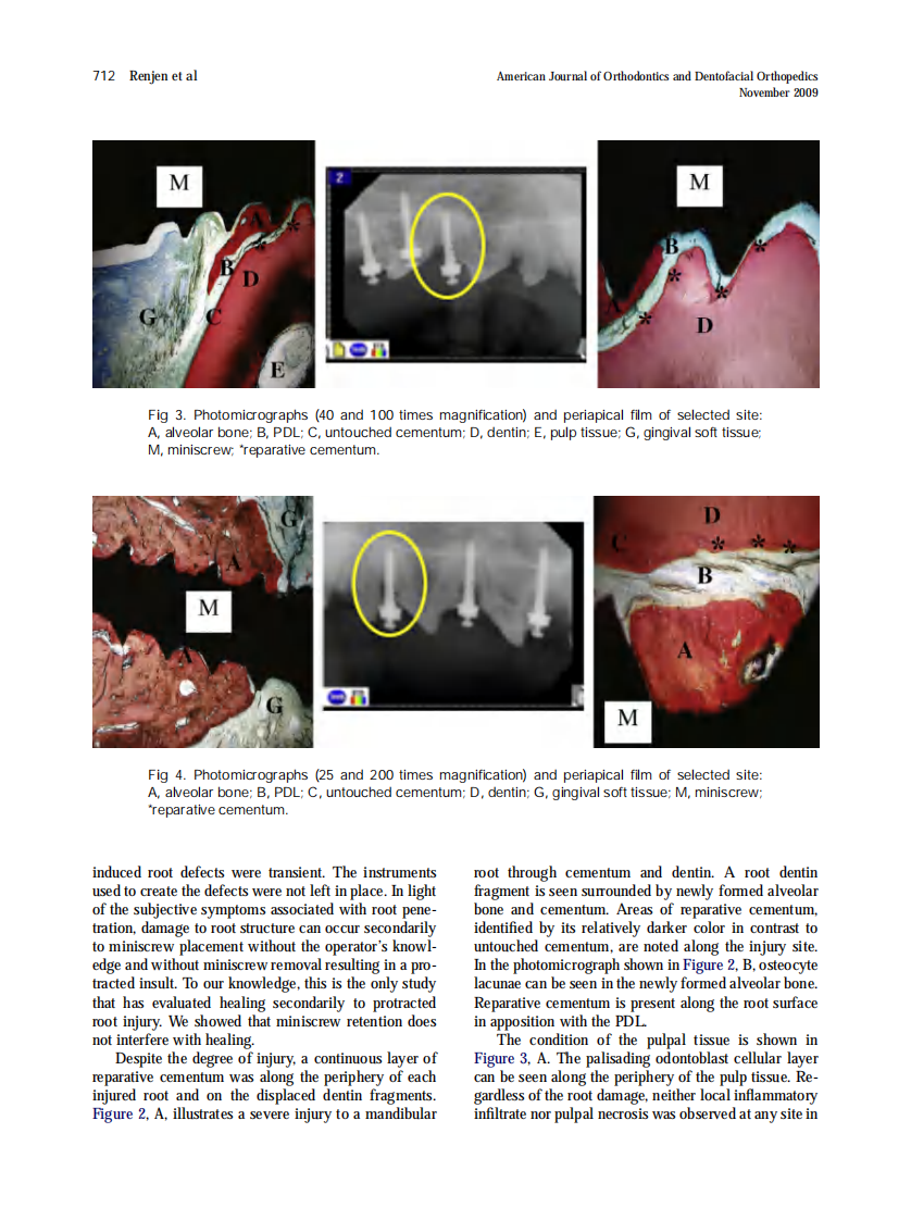 2009_136_5_708_714.pdf 第5页