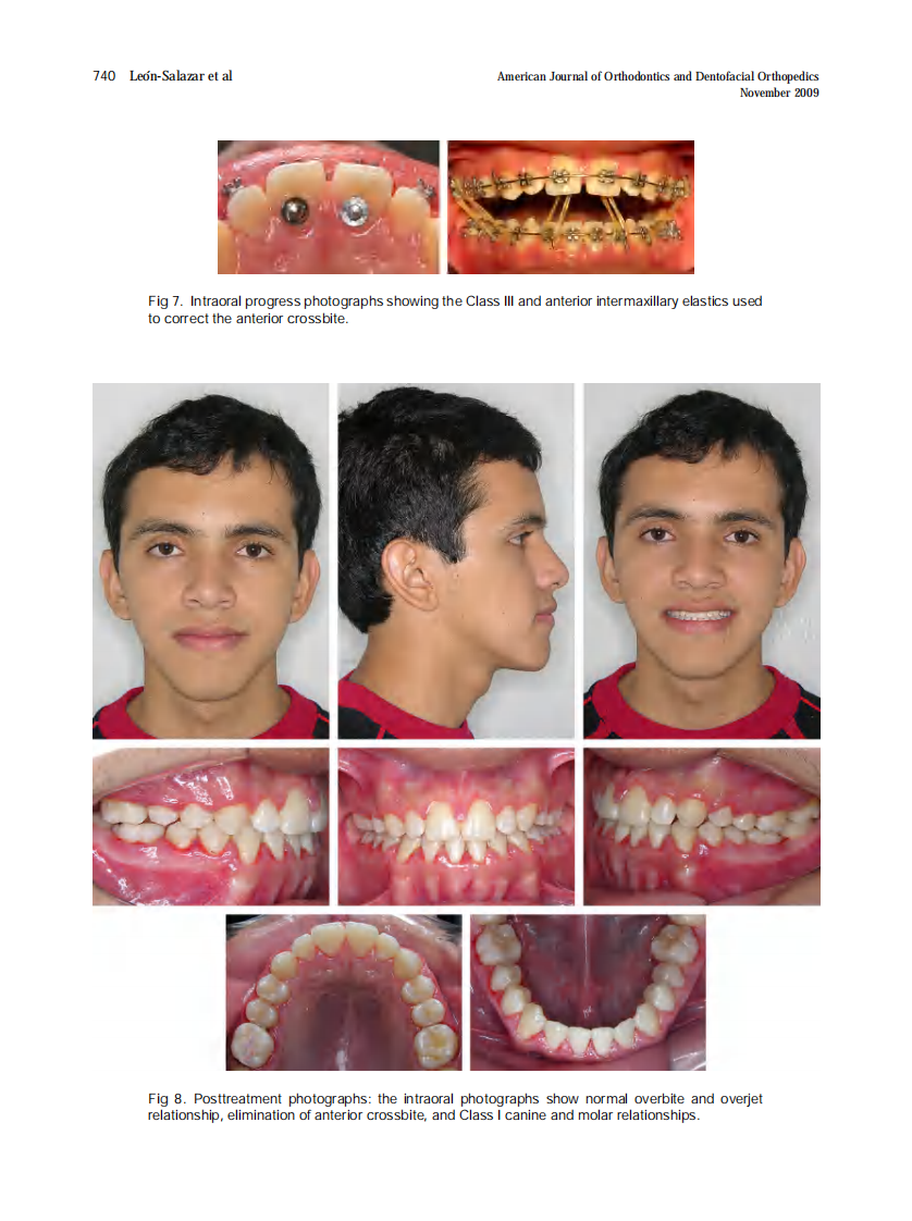 2009_136_5_736_745.pdf 第5页