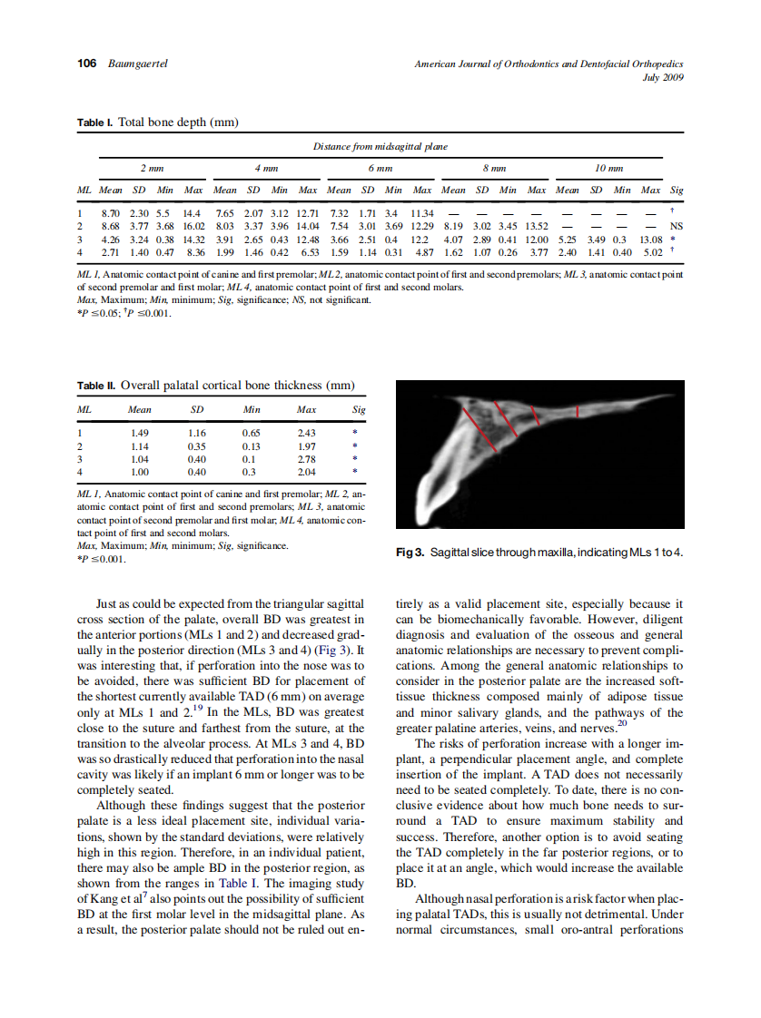 Baumgaertel_Quantitative-investigation-of-palatal-bone-depth-and-cortical-bone-thickness-for-mini-implant-placement-in-adults_2009.pdf 第3页