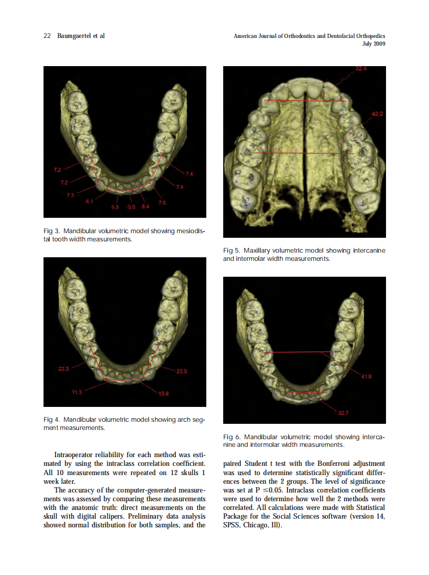 Baumgaertel_Reliability-and-accuracy-of-cone-beam-computed-tomography-dental-measurements_2009.pdf 第4页