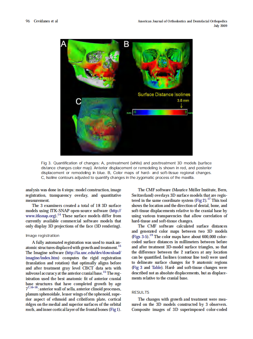 Cevidanes_Superimposition-of-3-dimensional-cone-beam-computed-tomography-models-of-growing-patients_2009.pdf 第3页