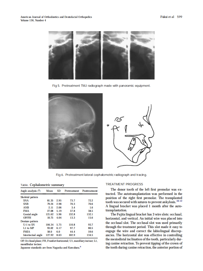 Fukui_2009_American-Journal-of-Orthodontics-and-Dentofacial-Orthopedics.pdf 第4页
