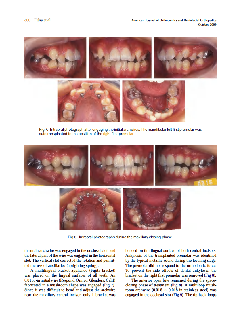 Fukui_2009_American-Journal-of-Orthodontics-and-Dentofacial-Orthopedics.pdf 第5页