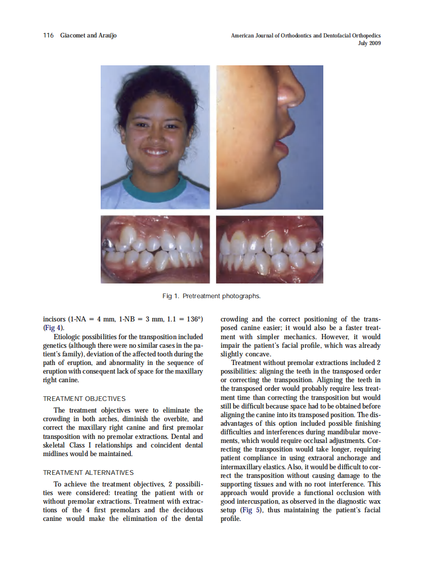 Giacomet_Orthodontic-correction-of-a-maxillary-canine-first-premolar-transposition_2009.pdf 第2页