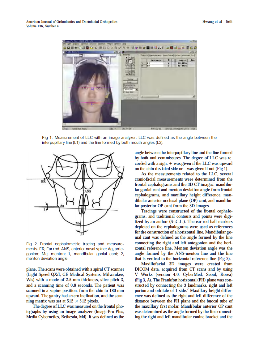 Hwang_2009_American-Journal-of-Orthodontics-and-Dentofacial-Orthopedics.pdf 第2页