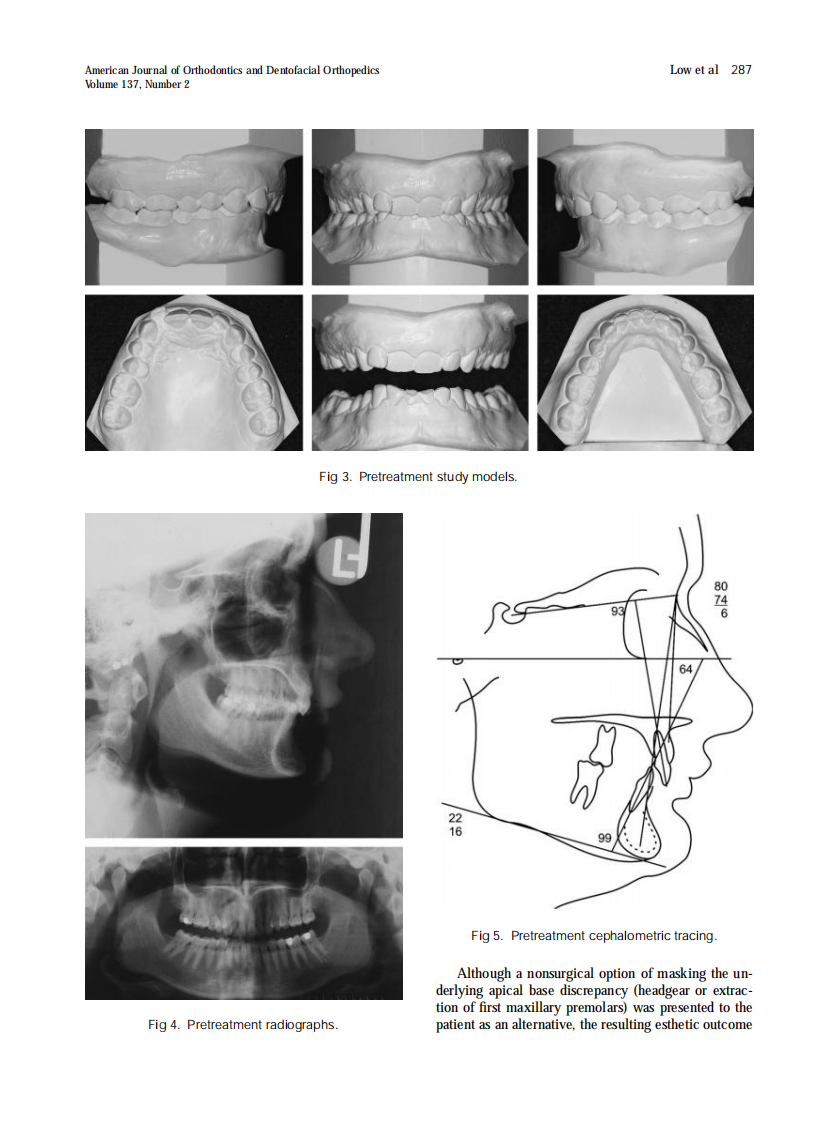 2010_137_2_285_292.pdf 第3页