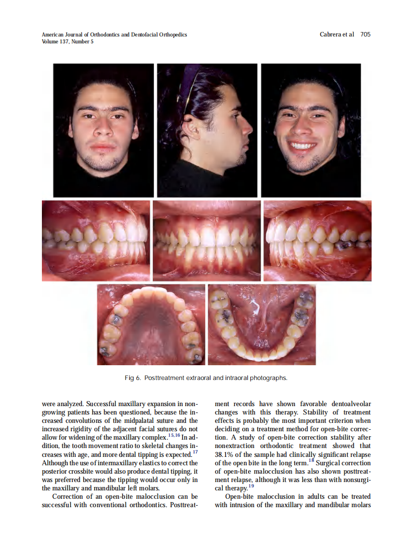 2010_137_5_701_711.pdf 第5页