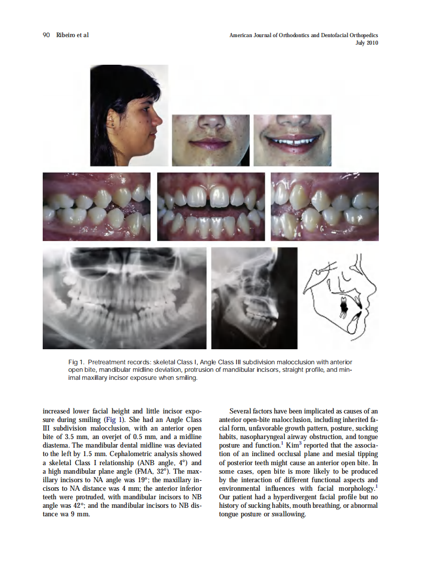 2010_138_1_89_95.pdf 第2页