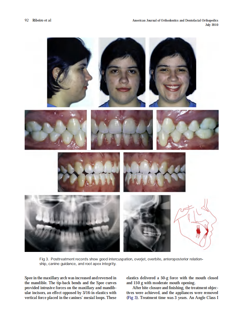 2010_138_1_89_95.pdf 第4页