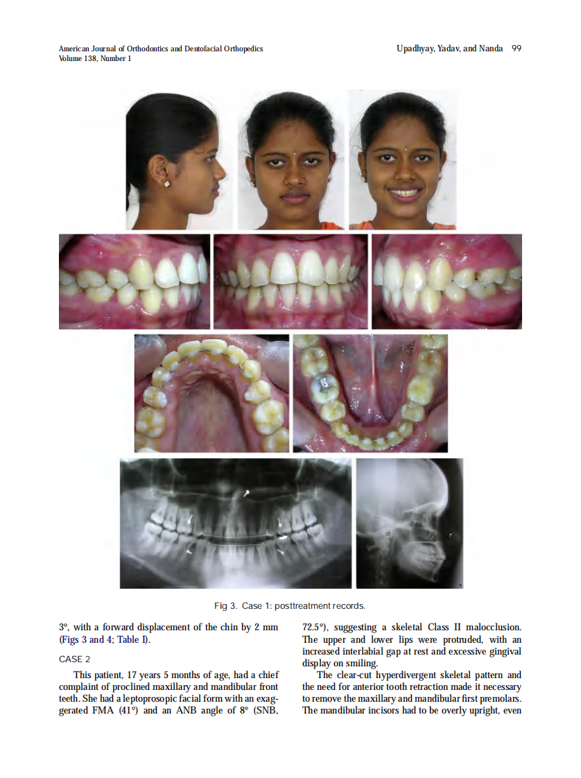 2010_138_1_96_108.pdf 第4页