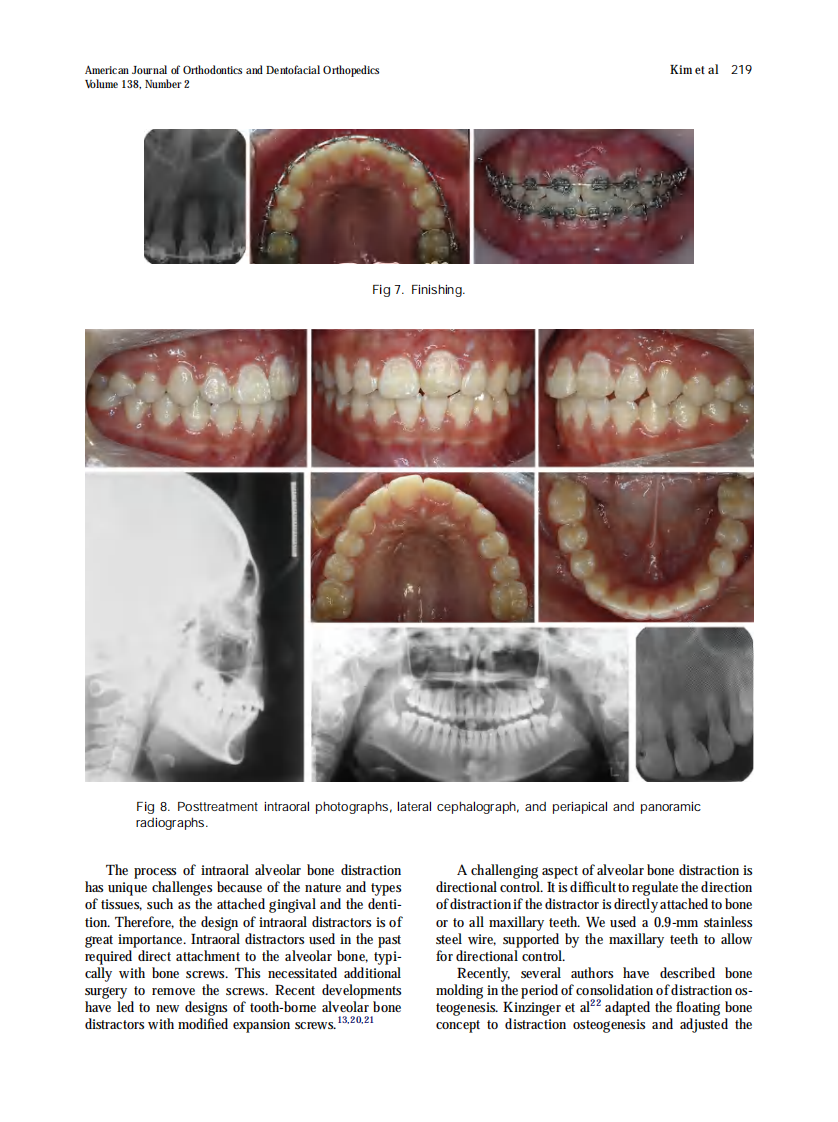 2010_138_2_215_220.pdf 第5页