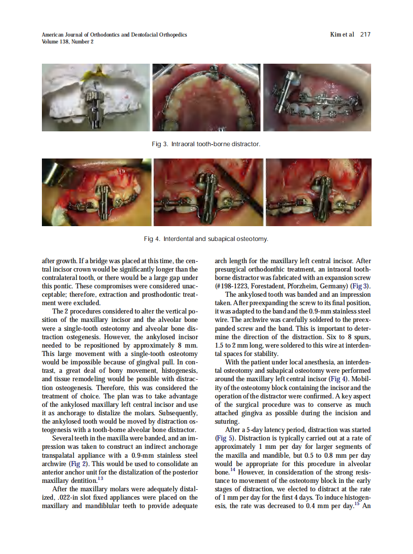 2010_138_2_215_220.pdf 第3页