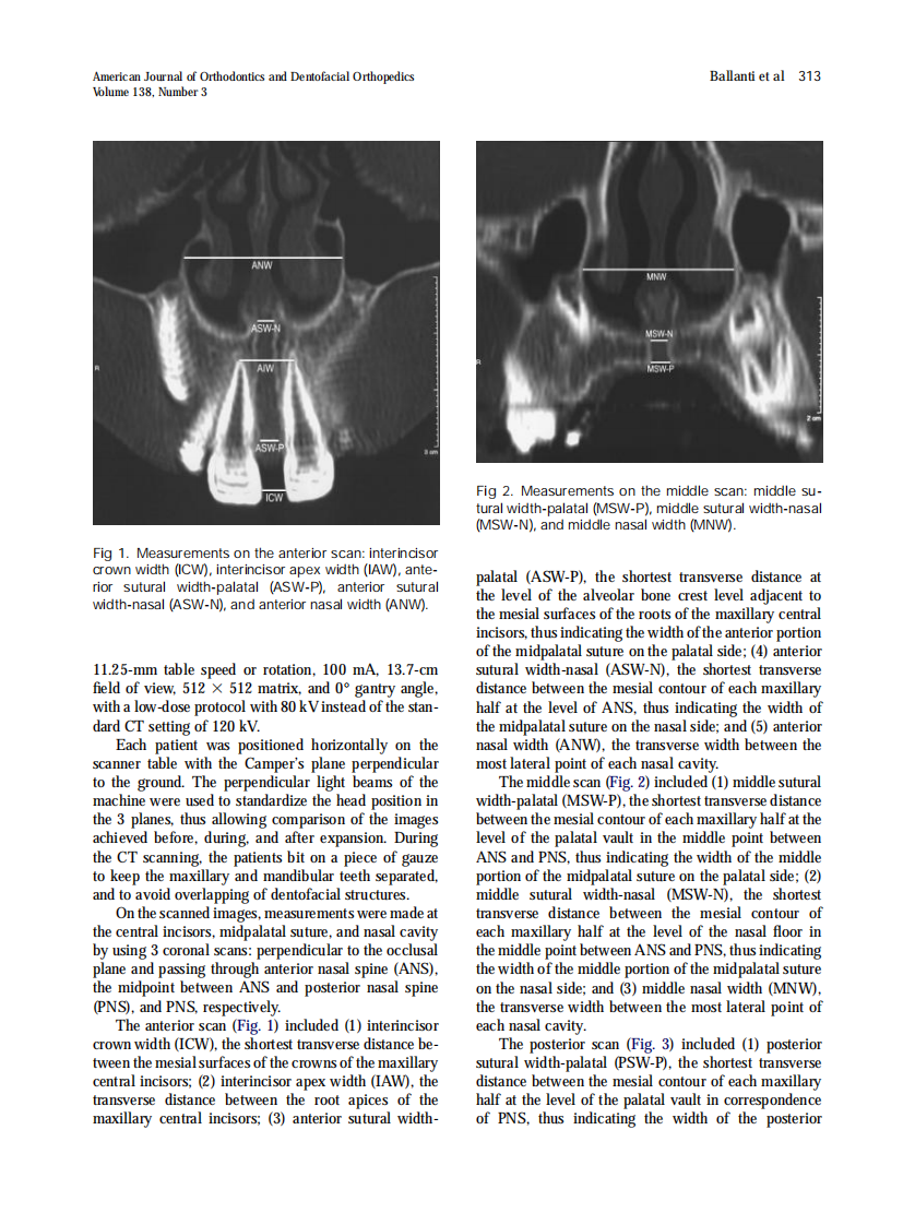 2010_138_3_311_317.pdf 第3页