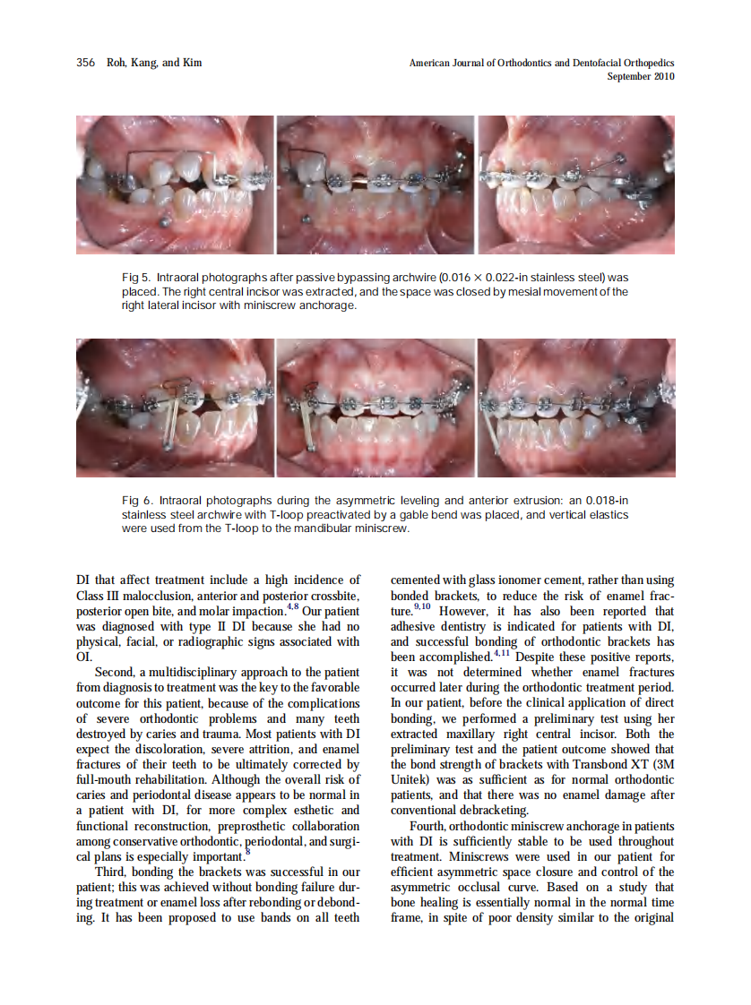 2010_138_3_352_360.pdf 第5页