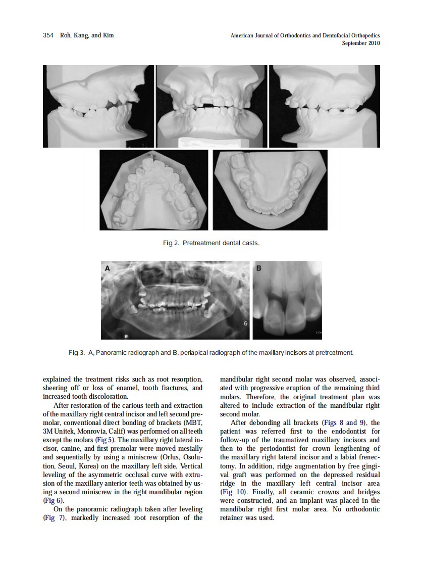 2010_138_3_352_360.pdf 第3页