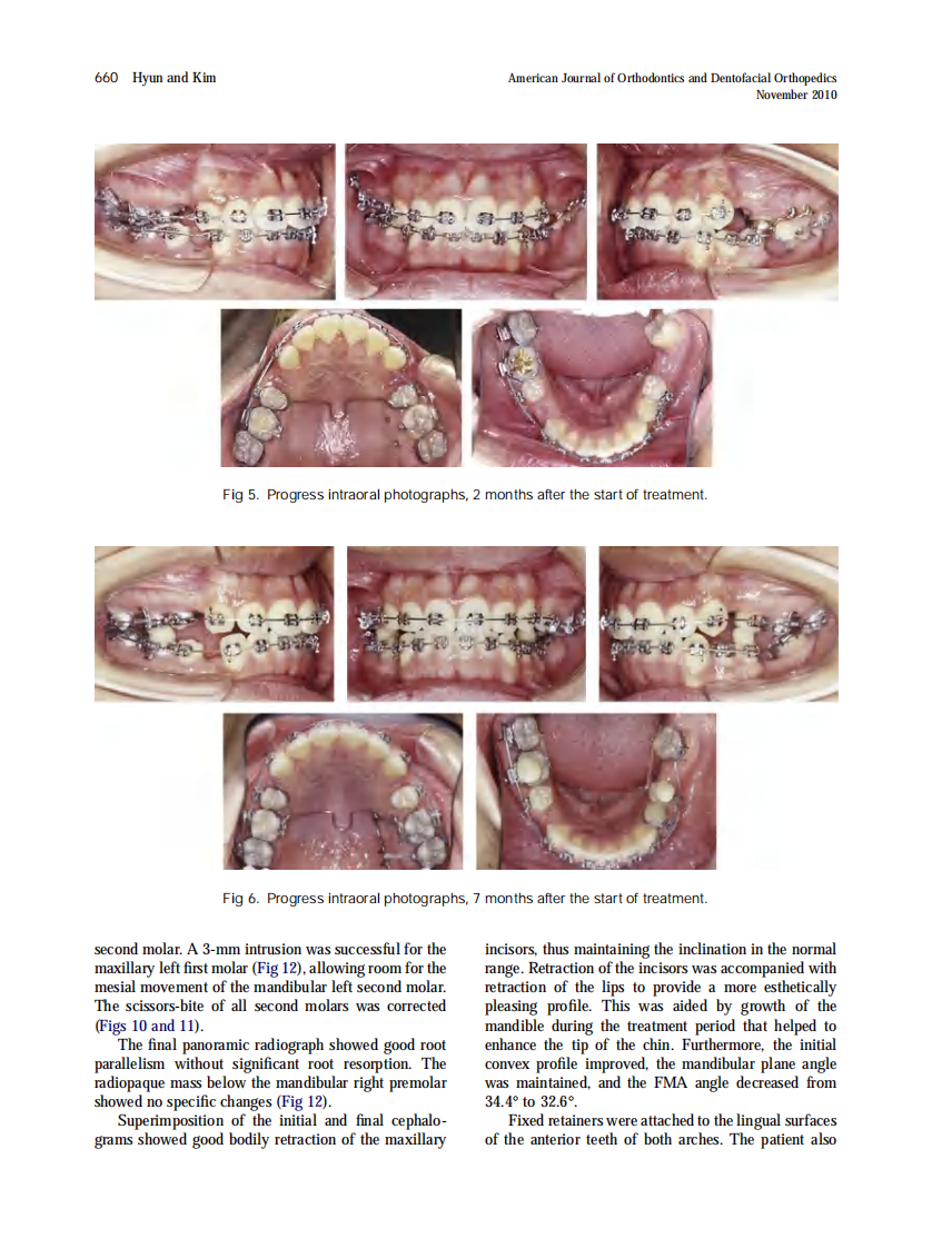 2010_138_5_656_665.pdf 第5页
