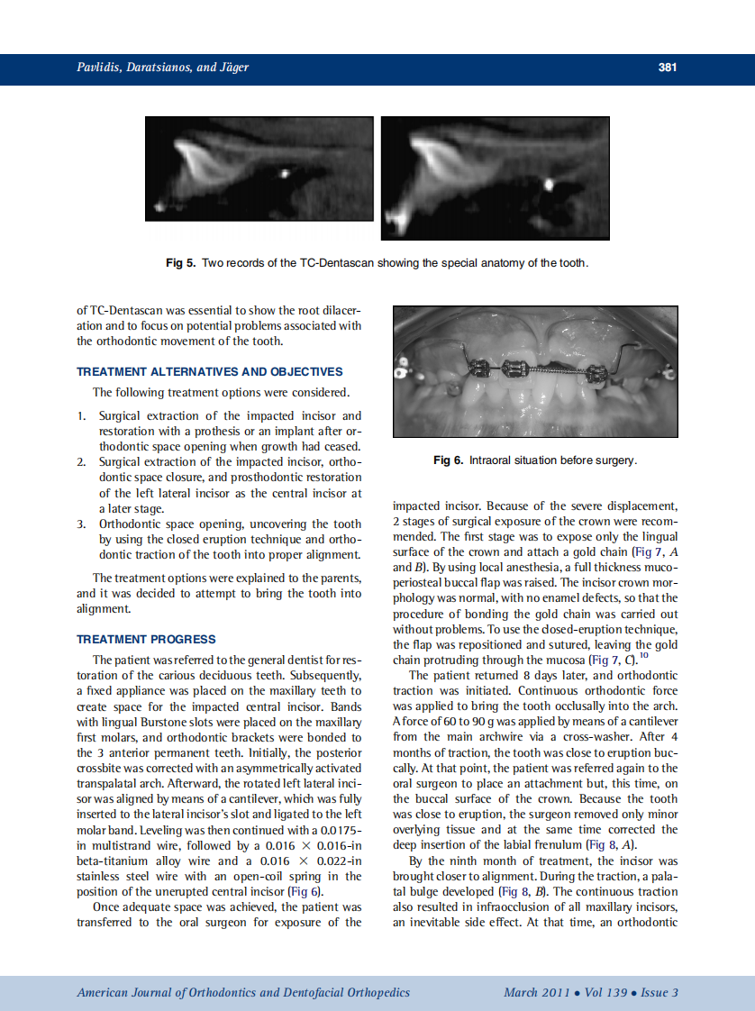 2011_139_3_378_387.pdf 第4页