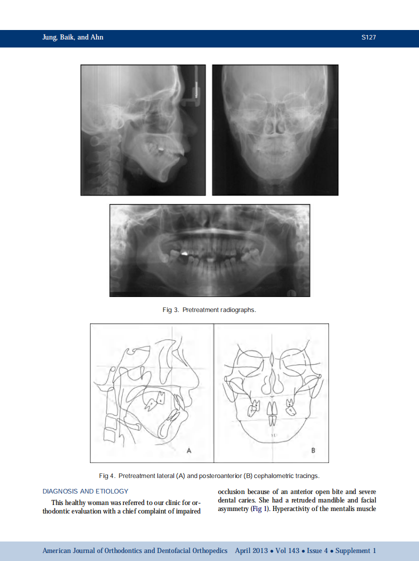 1-s2.0-S0889540612008700-main.pdf 第3页