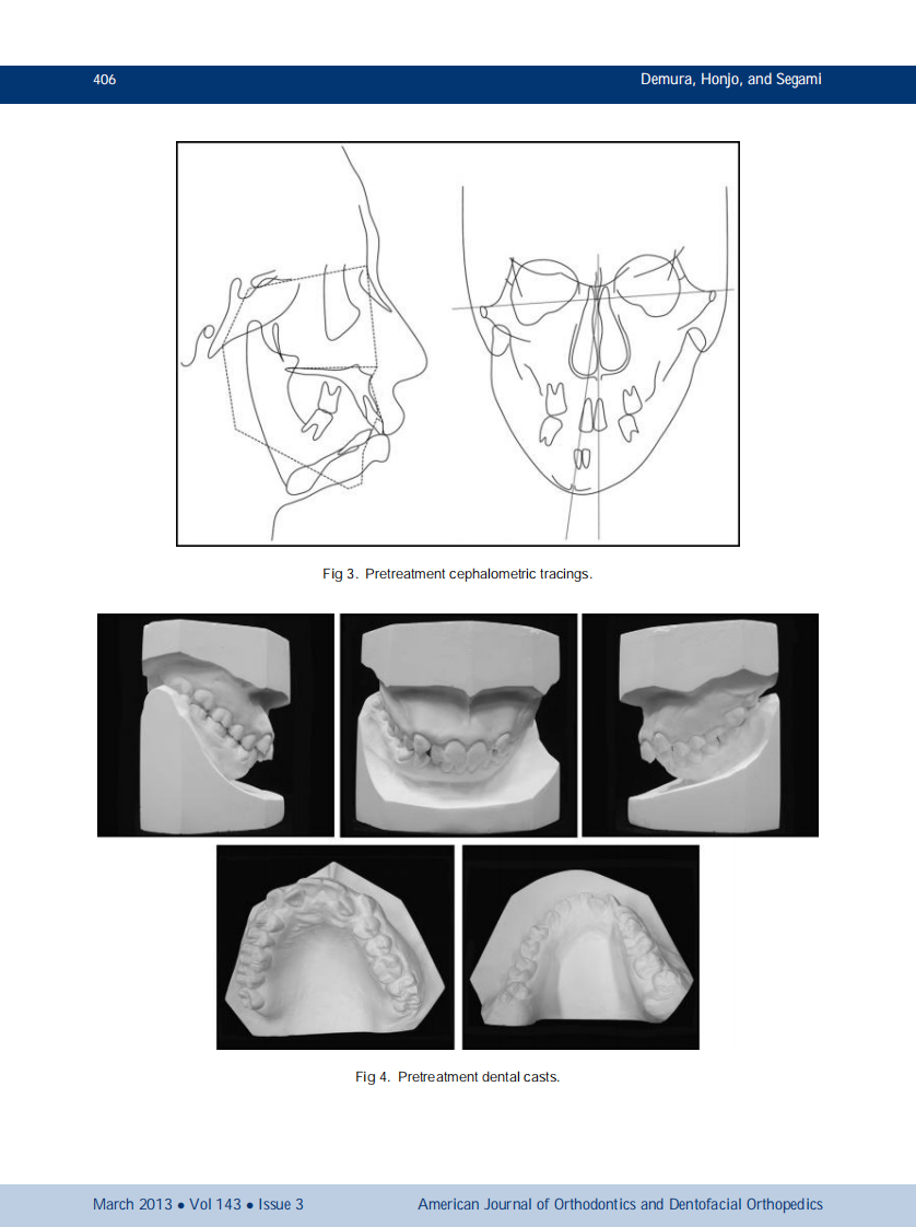 1-s2.0-S0889540612010906-main.pdf 第3页