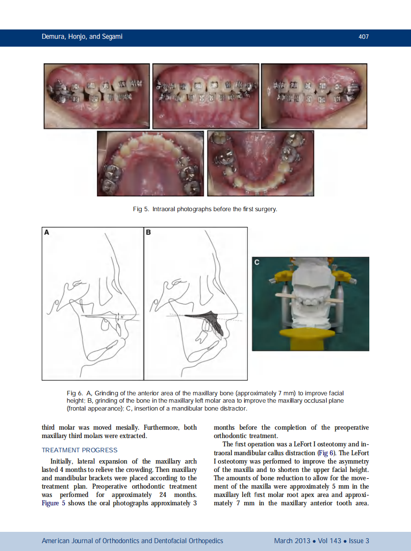 1-s2.0-S0889540612010906-main.pdf 第4页