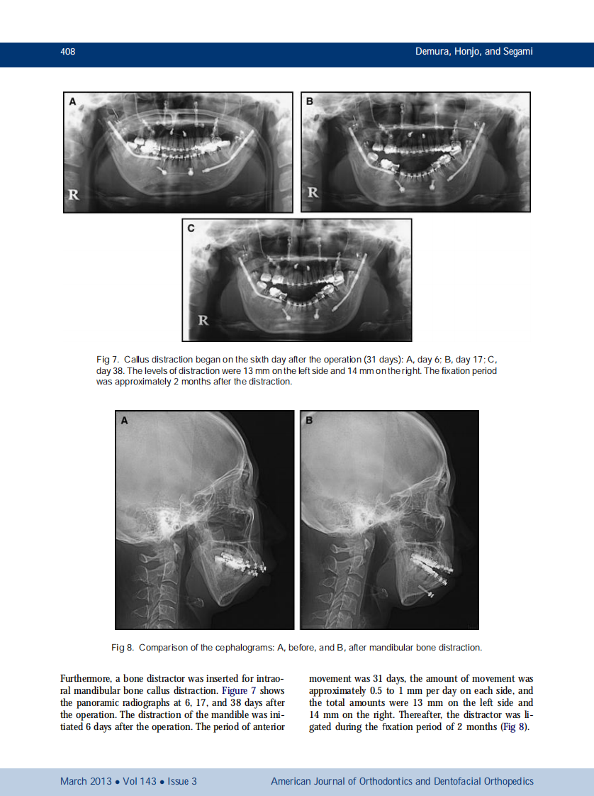 1-s2.0-S0889540612010906-main.pdf 第5页