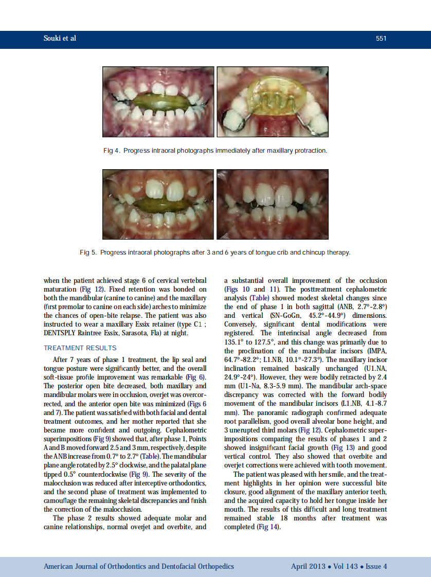 1-s2.0-S0889540613000164-main.pdf 第5页