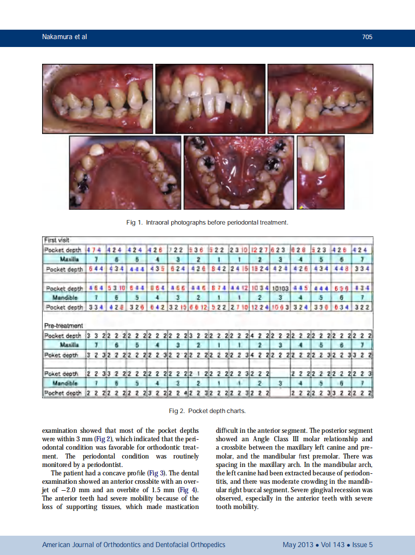 1-s2.0-S0889540613000759-main.pdf 第2页