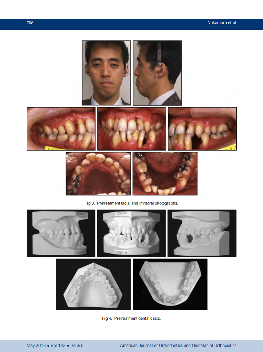 1-s2.0-S0889540613000759-main.pdf 第3页