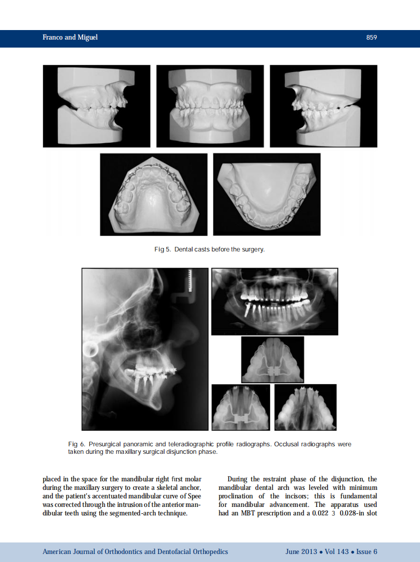 1-s2.0-S0889540613001649-main.pdf 第5页