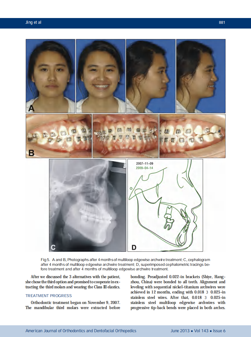 1-s2.0-S0889540613001650-main.pdf 第5页