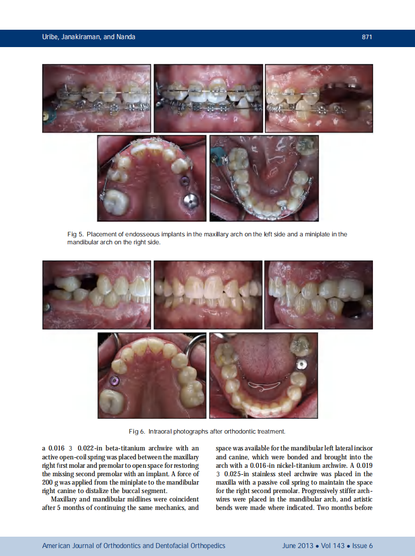 1-s2.0-S0889540613001662-main.pdf 第5页