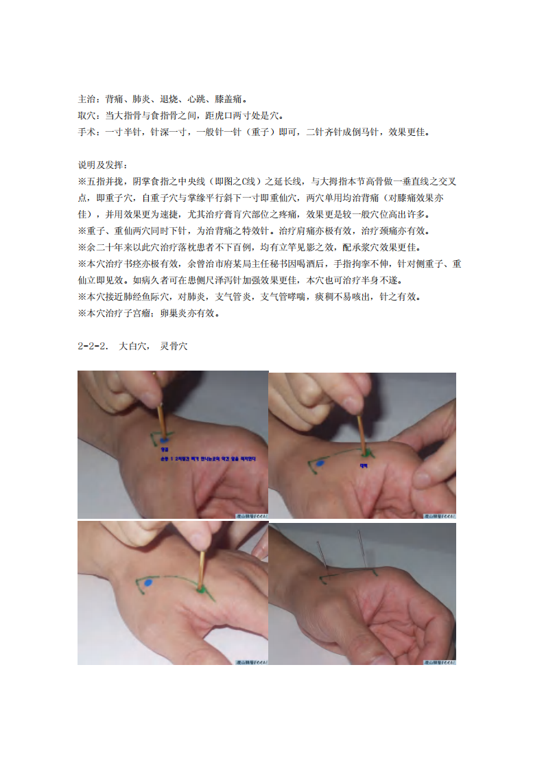 董氏奇穴发挥整理2-2.pdf 第2页