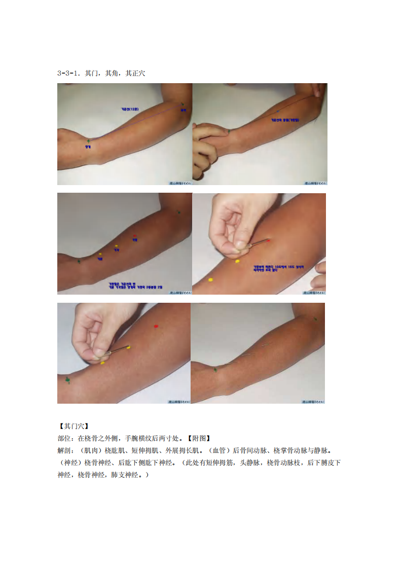 董氏奇穴发挥整理3-3.pdf 第1页