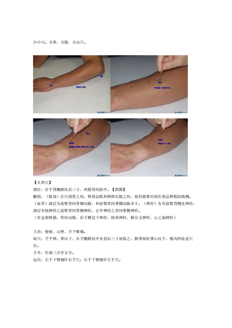 董氏奇穴发挥整理3-3.pdf 第3页