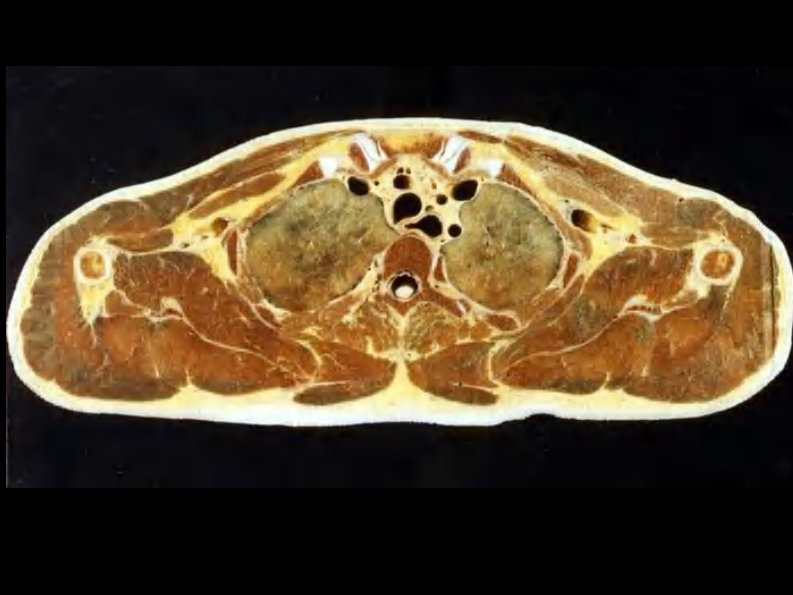 07 纵隔连续横断层解剖及CT.pdf 第2页