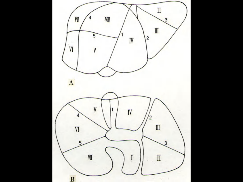 09 肝内管道和肝段断层解剖.pdf 第4页
